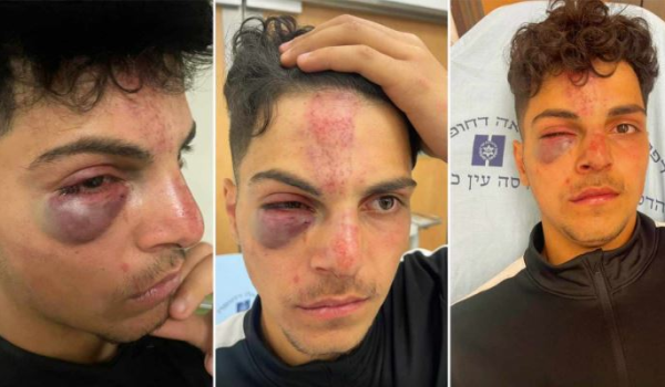 Israeli extremist settlers brutally assault teenager in occupied Jerusalem